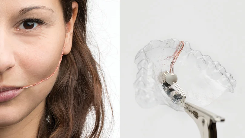 Tong by Dorothee Clasen, Germany